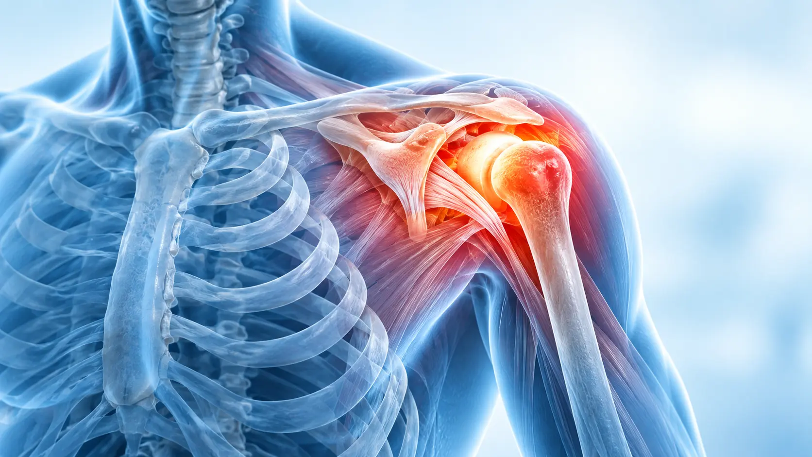 - Shoulder pain affecting the joint and surrounding tissues