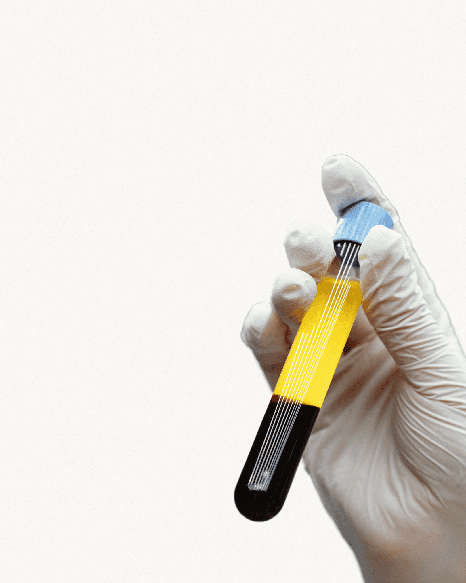 PRP facial rejuvenation treatment at aesthetic clinic in Irvine California