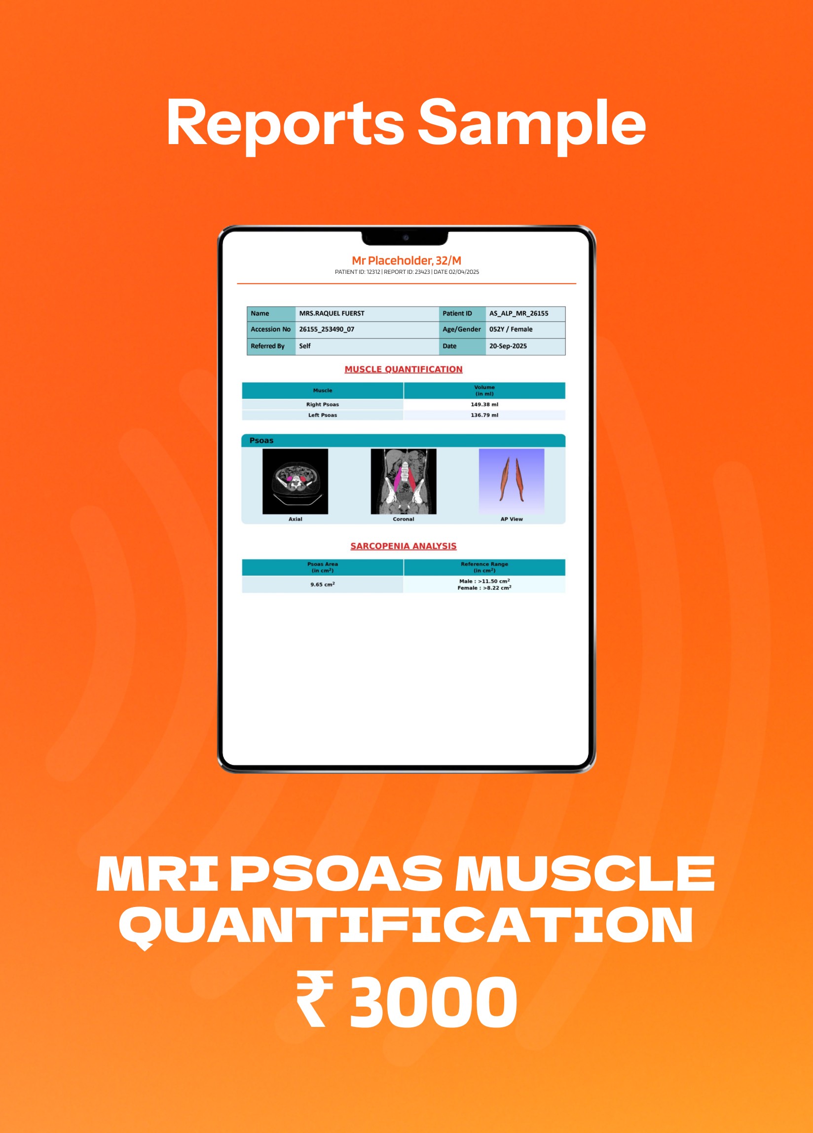 a gloved hand holding a test tube filled with liquid