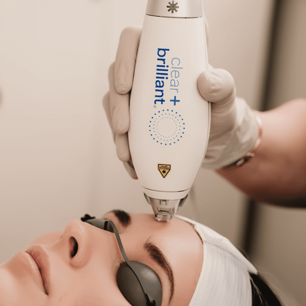 Clear + Brilliant® Laser Treatment