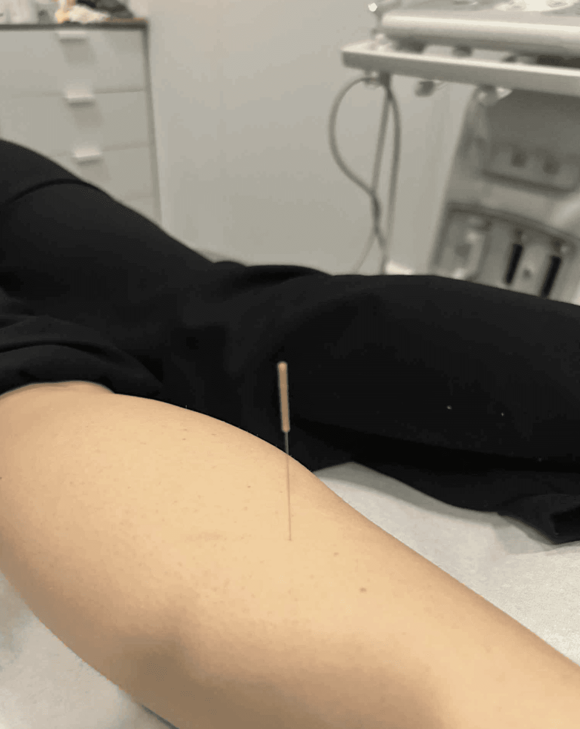 Akupunktur Flekkefjord