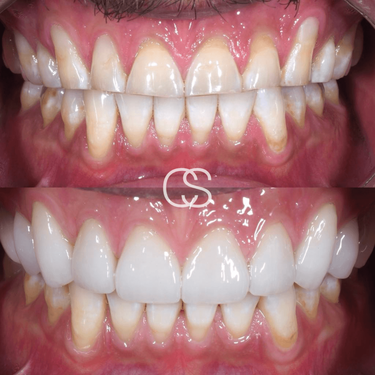 Before & After