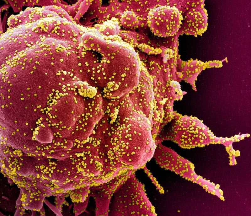 Novel Coronavirus Microscopic