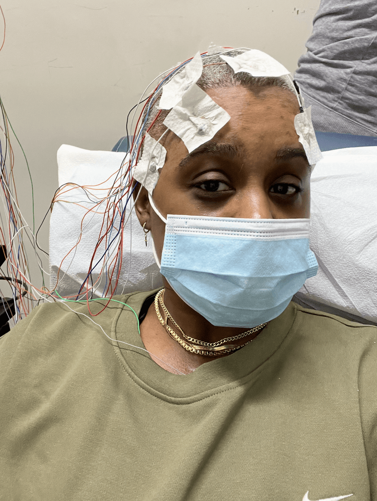 Ashleigh Warren wearing a mask and hospital attire sits with bandages on their head for testing, looking at the camera.