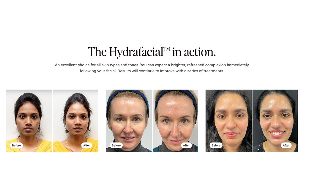 Before/After Figma Section