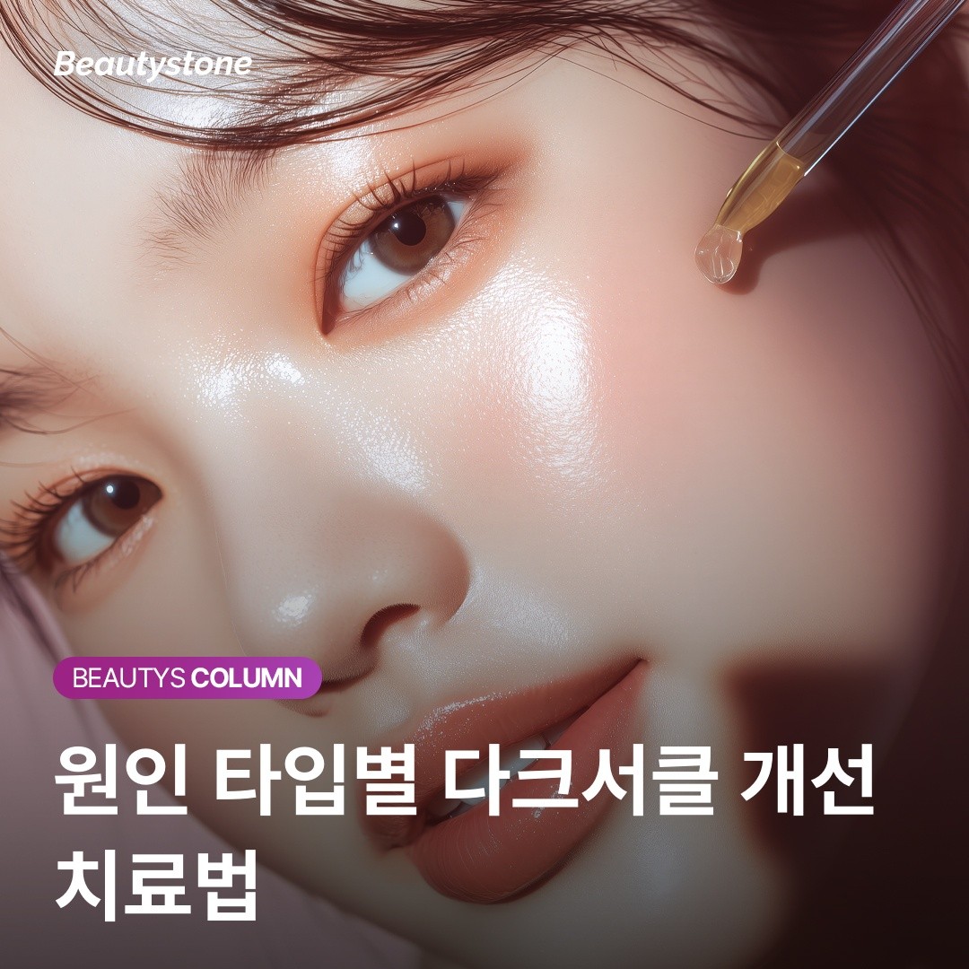 다크서클 원인별 맞춤 치료법: 색소형 vs 혈관형 vs 구조형
