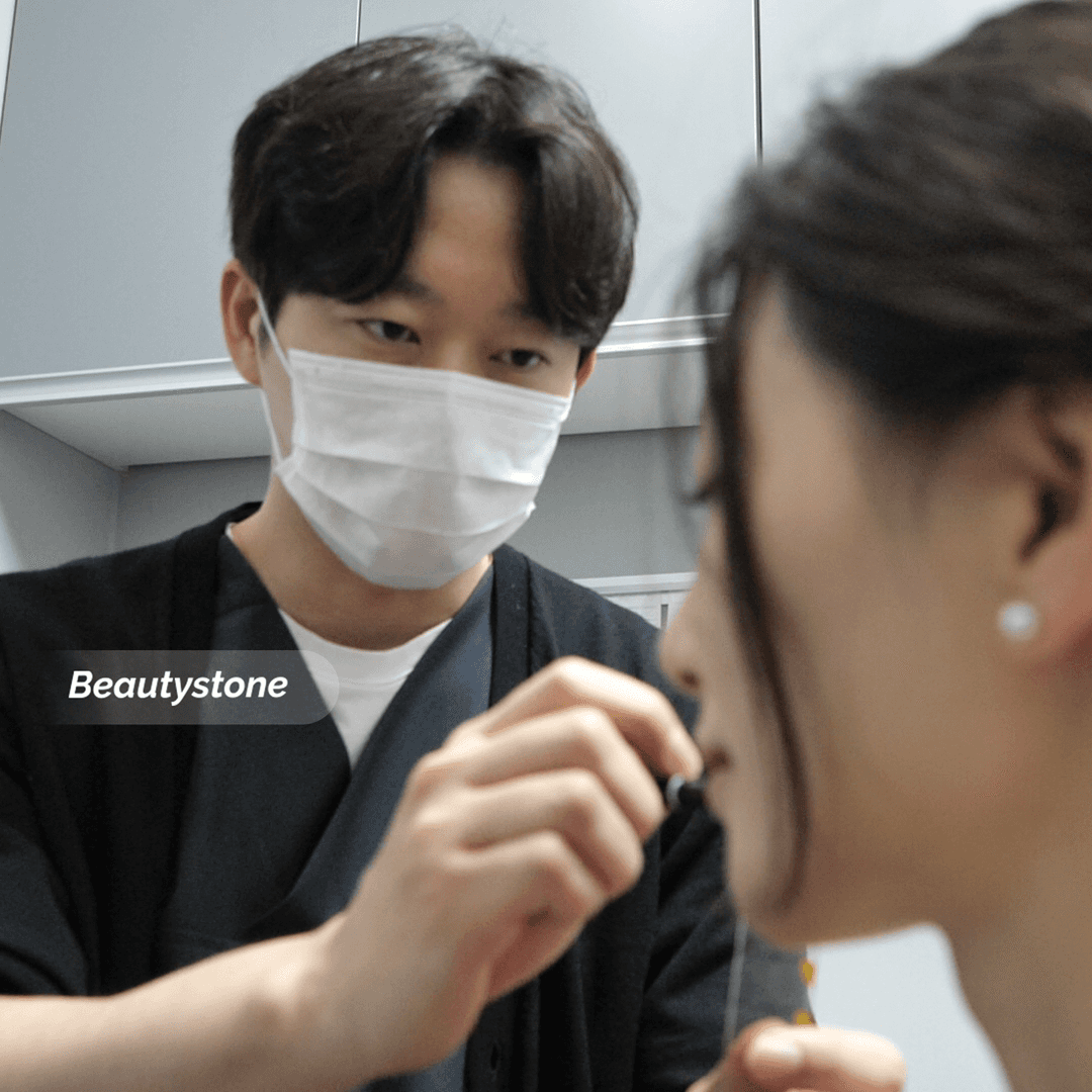 남자 얼굴 제모 부위별 효과 차이   — 수염·솜털·이마 비교