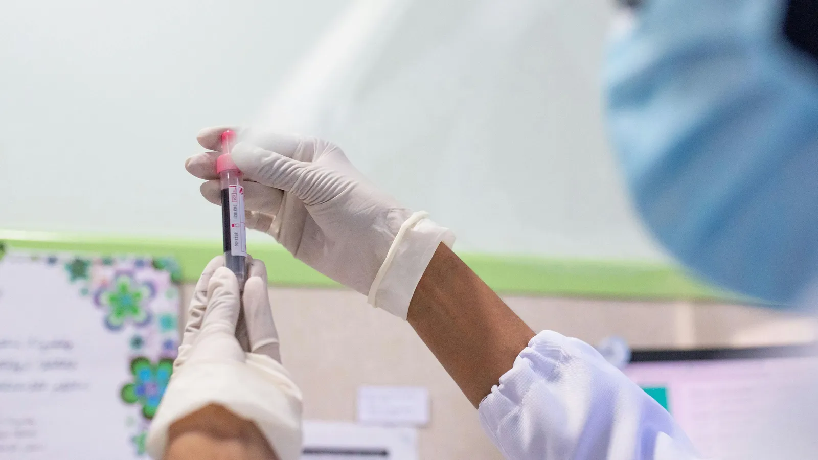 What Are Normal Alkaline Phosphatase Levels?