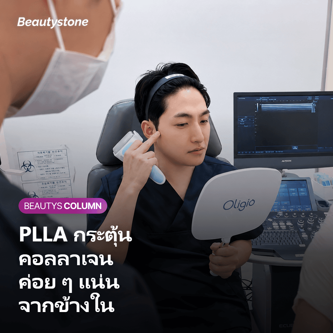 Sculptra คืออะไร และทำงานอย่างไรกับผิวคอ