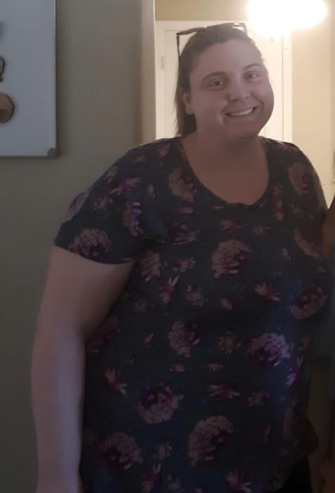 Jennifer P. before
