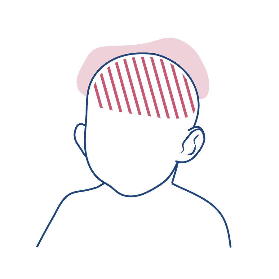 Ilustração de um homem de costas, com a parte da coluna sinalizada, representando a dor na região.
