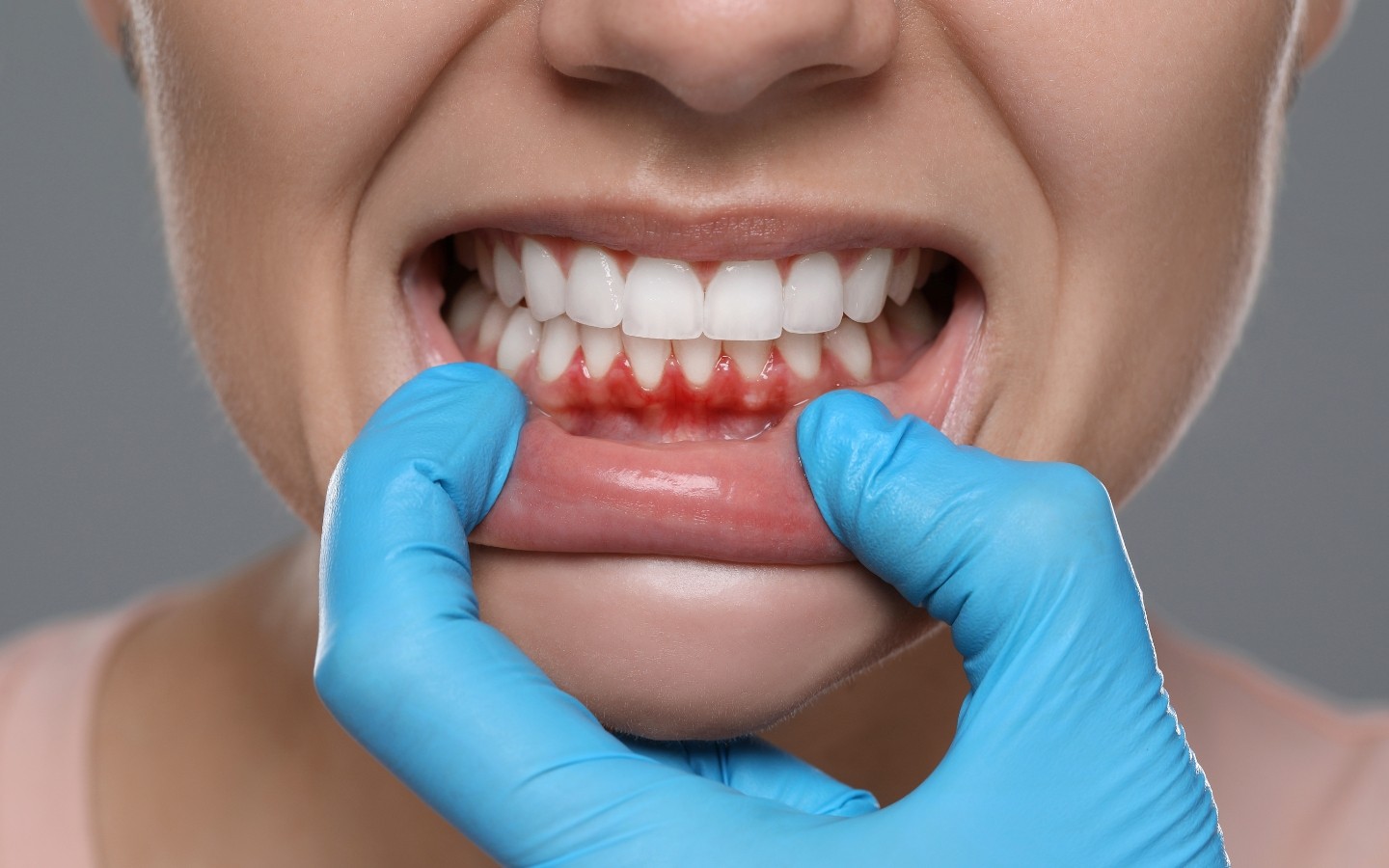 gum disease
