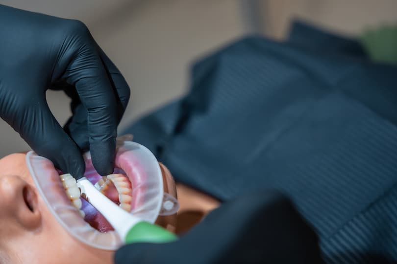 Preparação dos Dentes