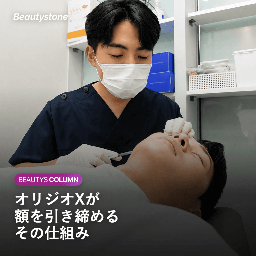 オリジオXが額を引き締める仕組みを示す図