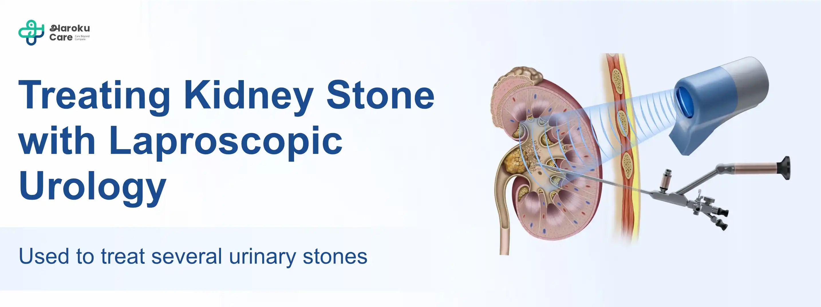 Gynecomastia before and after surgery results showing chest contour improvement