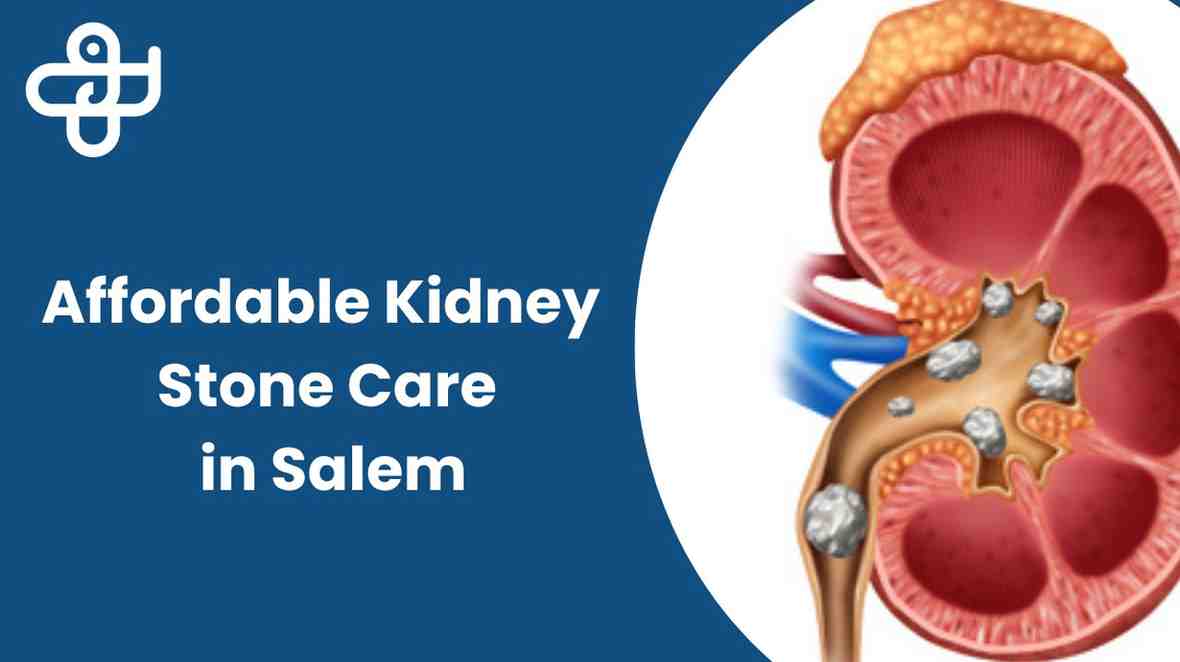 Laser Kidney stone surgery in Salem