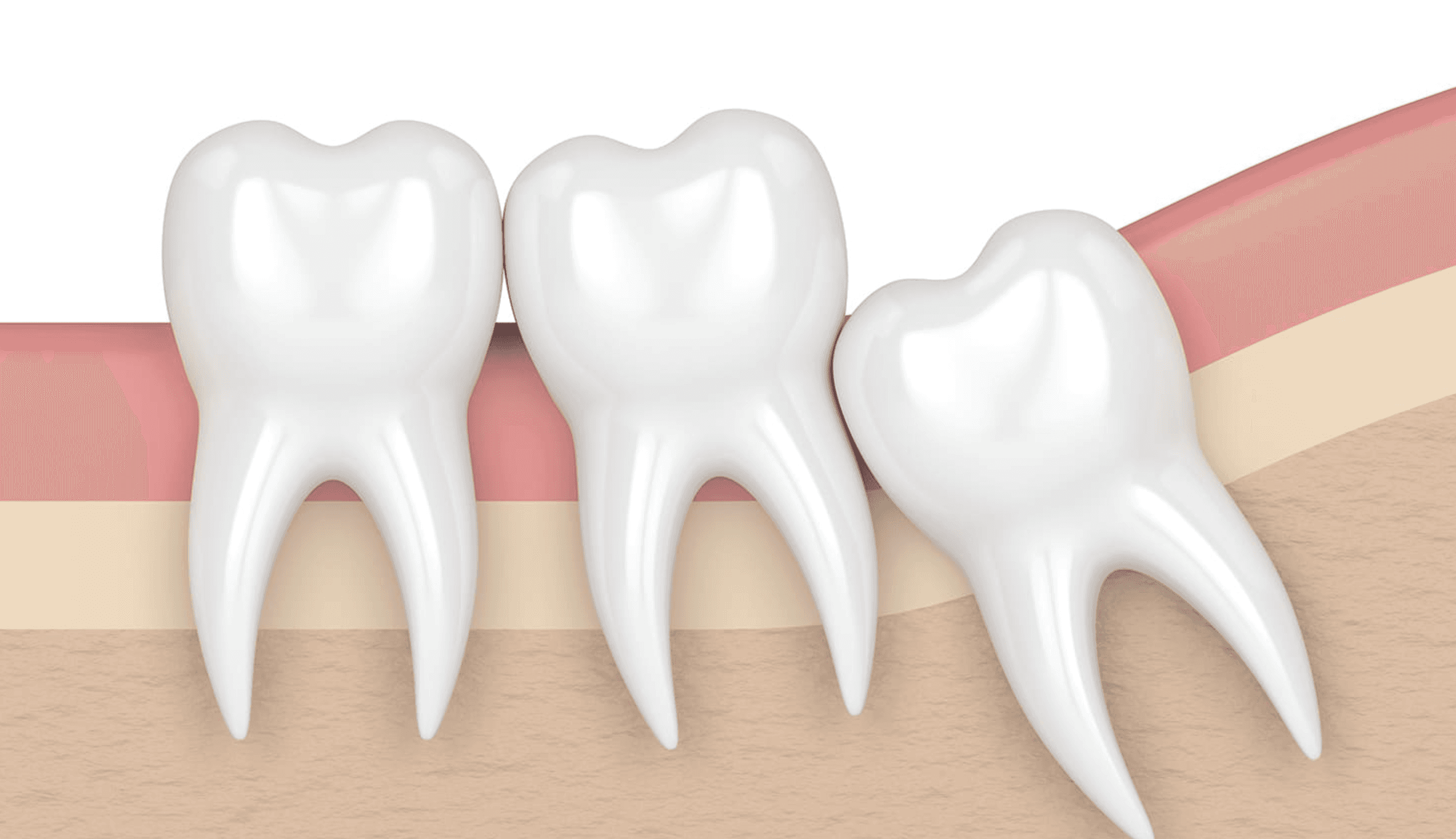 根管治療について