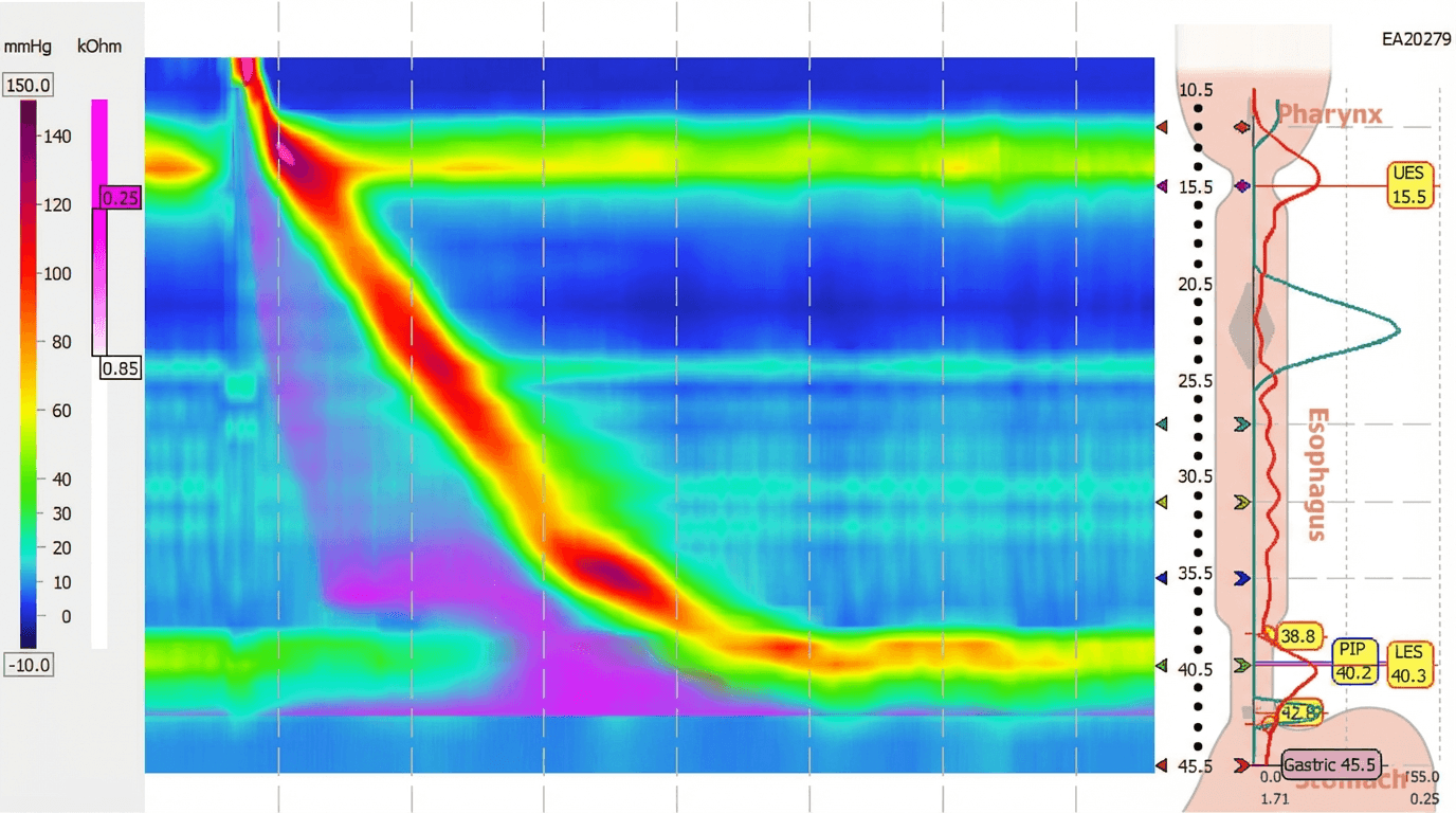 Özofagus ve Anorektal Manometri: Sindirim Sisteminin Kas Fonksiyonlarını Değerlendiren Tanısal Testler