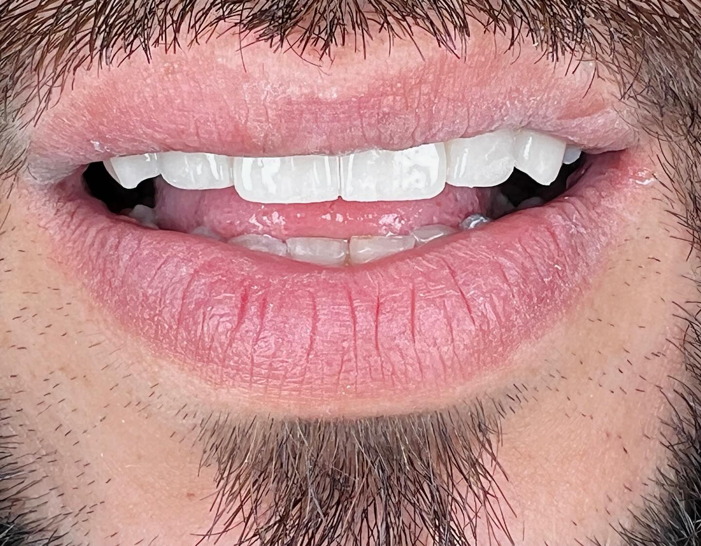Teeth Checkup