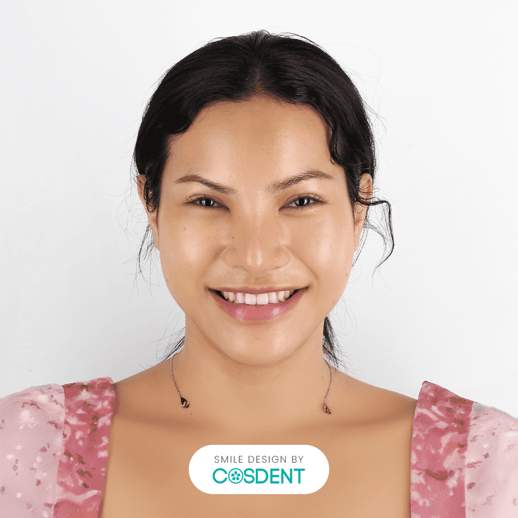 หน้าเพชร ยิ้มกว้าง 18 ซี่