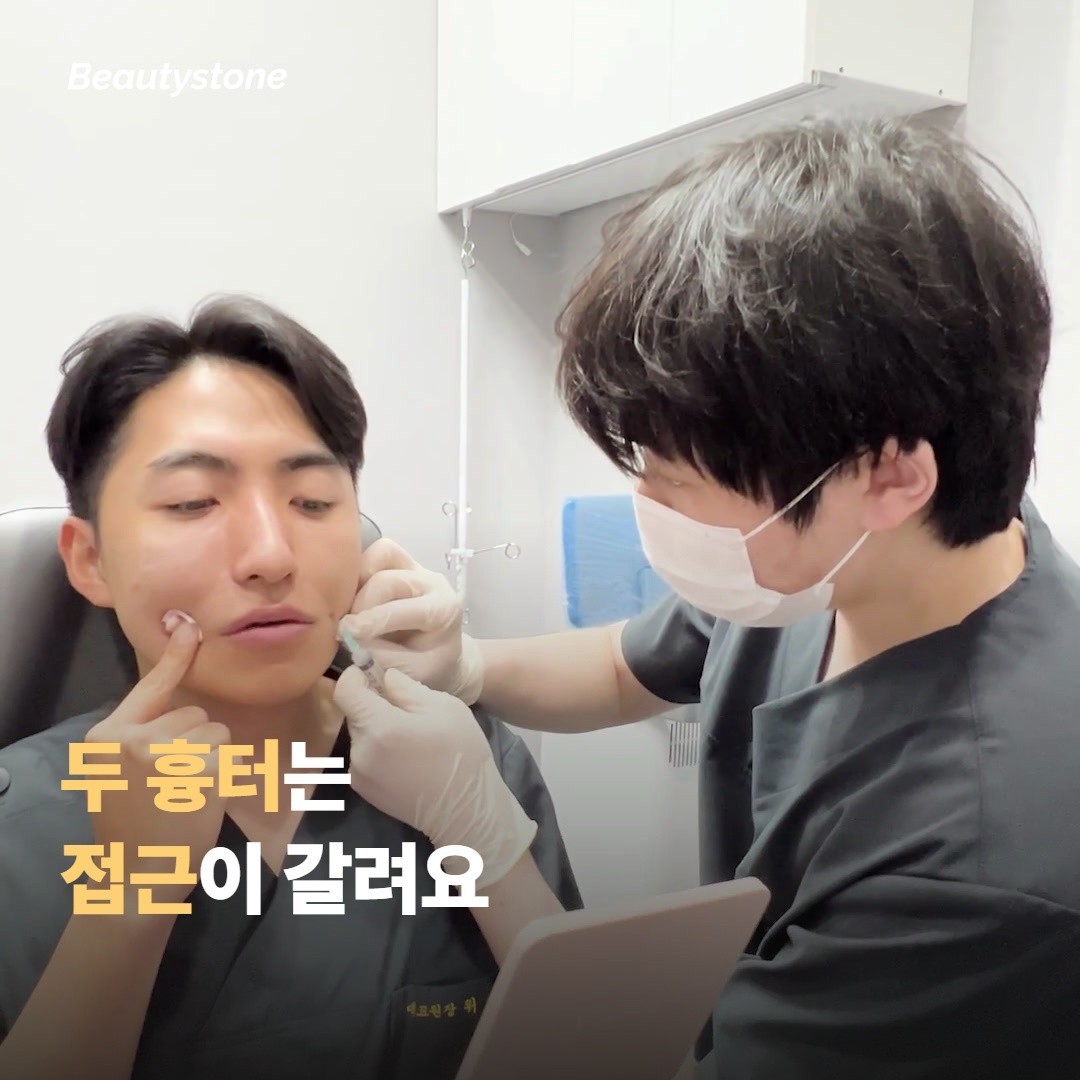 두 흉터는 관리 접근의 차이가 있어요