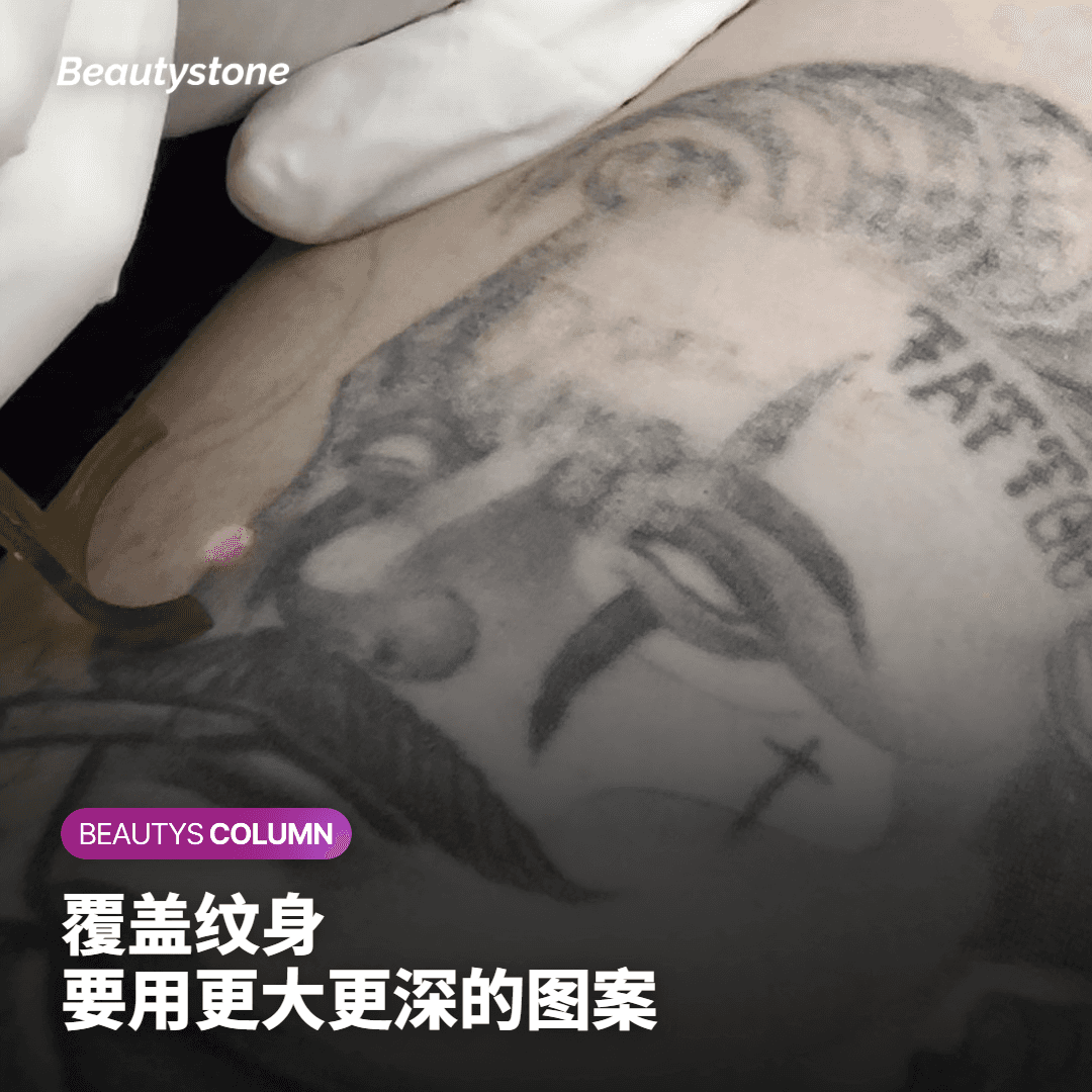 覆盖纹身要用比原有墨水更大、更深的图案来遮盖