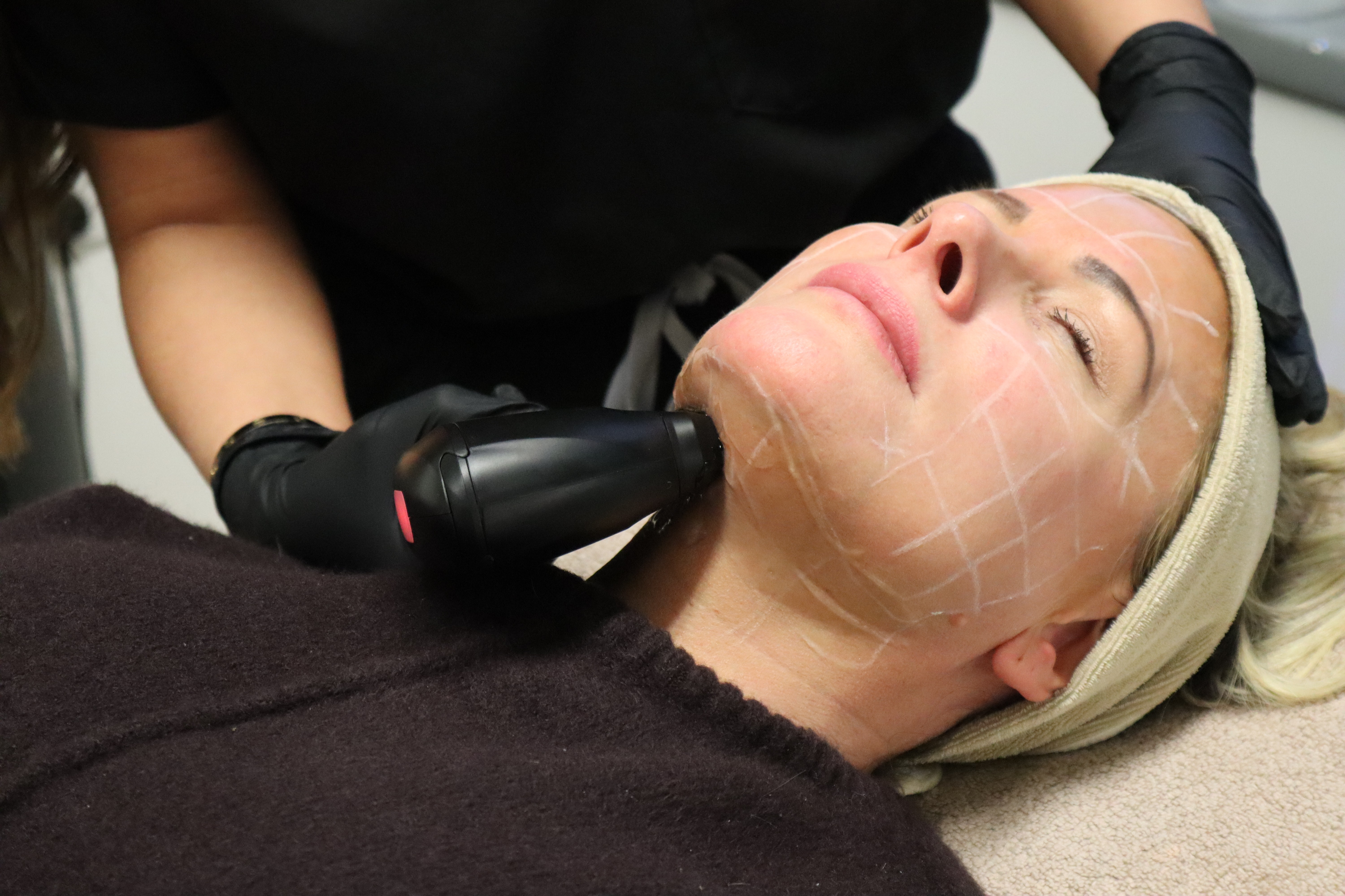 client undergoing ultratight treatment