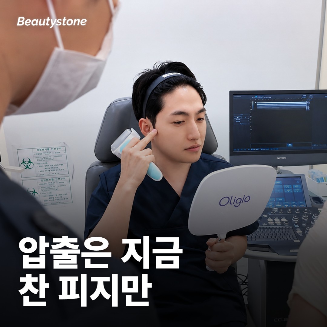 압출·스케일링·레이저는 무엇이 다른가요?