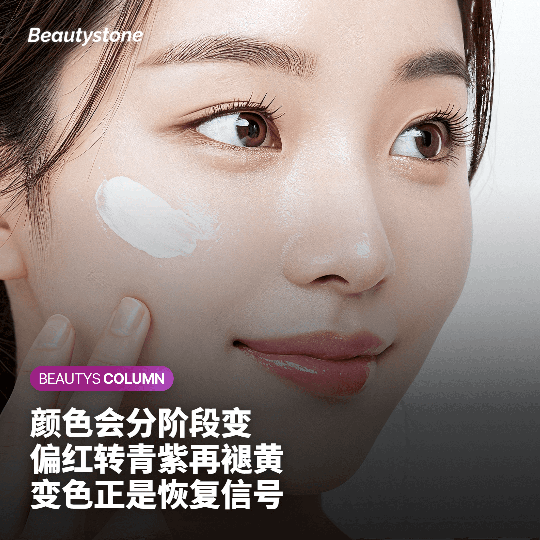 瘀青为什么出现又会变色