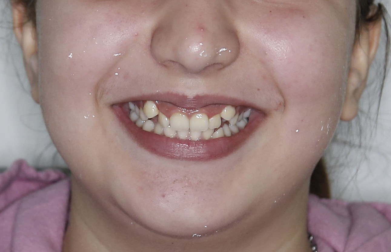 Image of teeth checkup