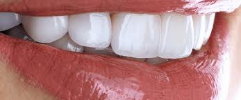 cosmetic dentistry