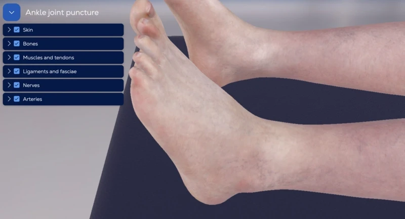 Ankle joint injection (subtalar and talocrural joint)