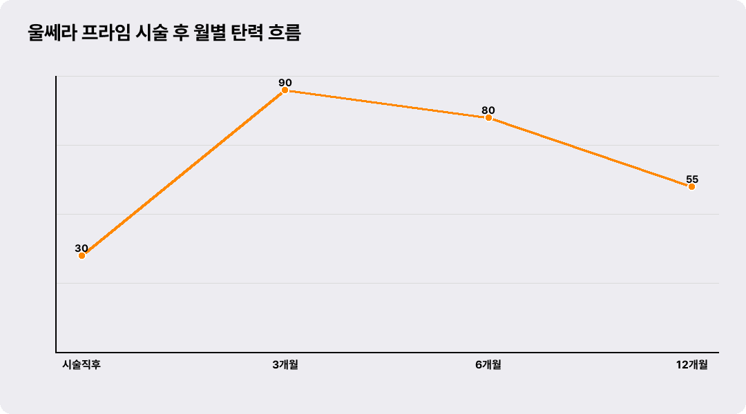 울쎄라 프라임 시술 후 월별 탄력 흐름