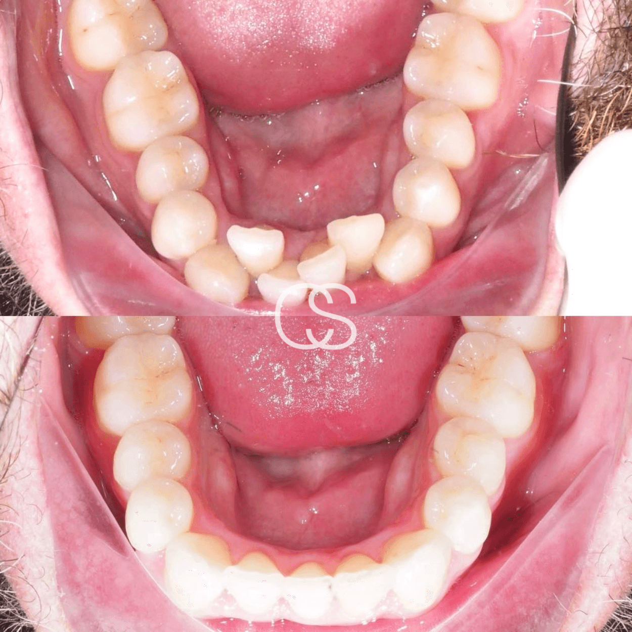Before & After