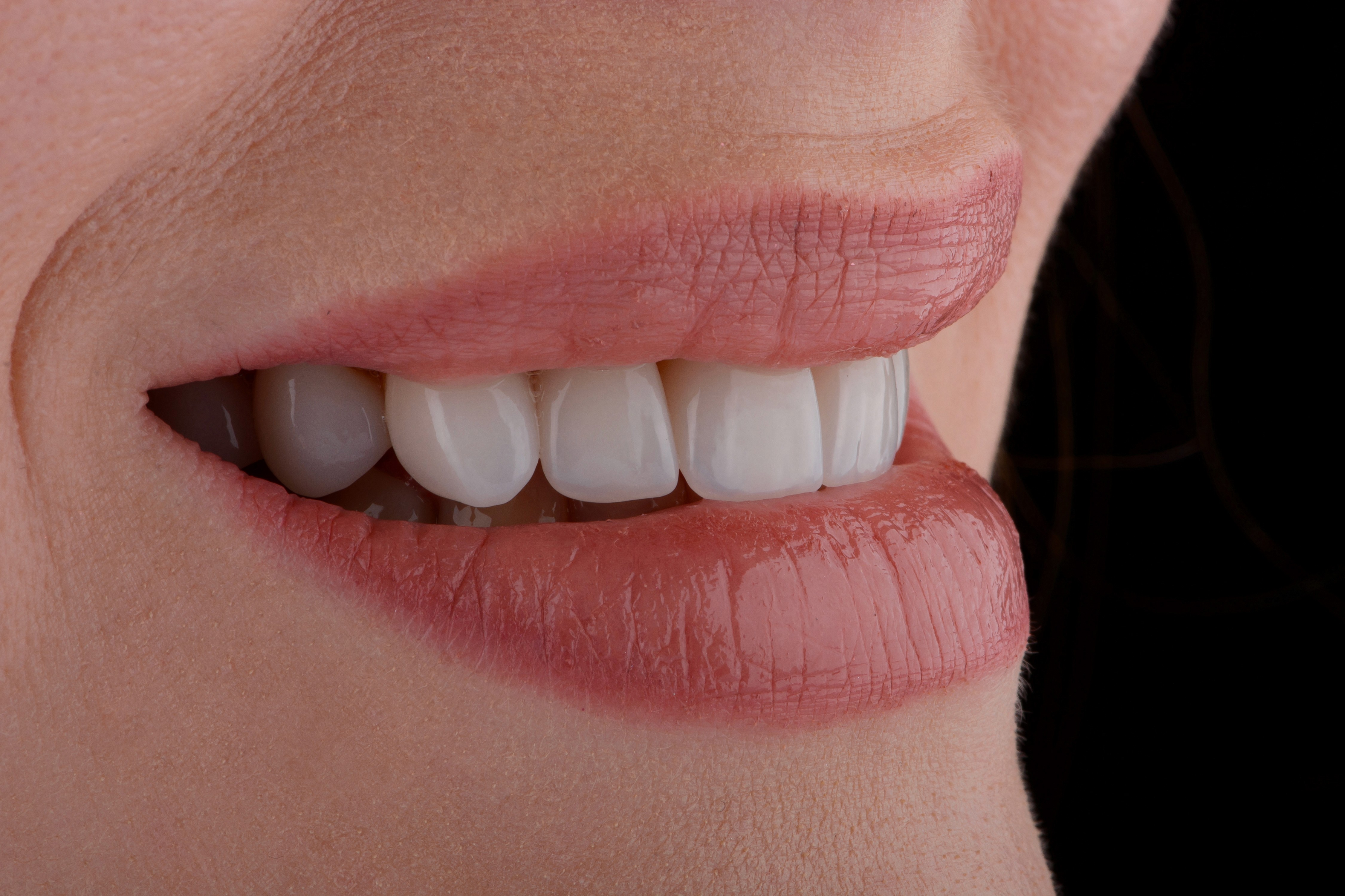 sonrisa