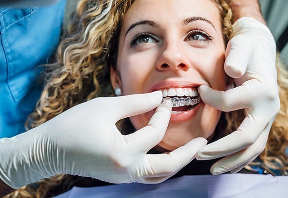 The Different Types Of Invisalign Treatment In Abu Dhabi