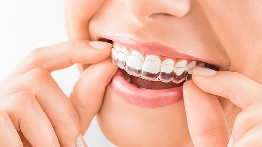 Teeth Checkup