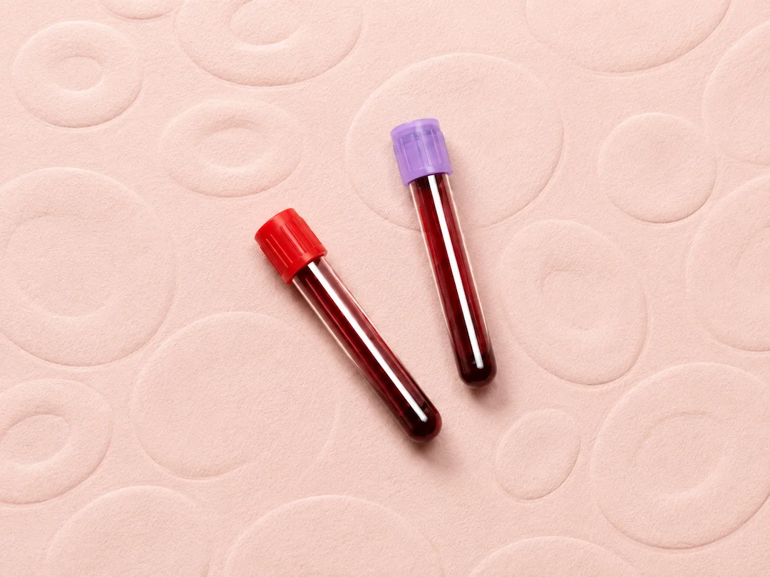 Two vials of blood on a cream background