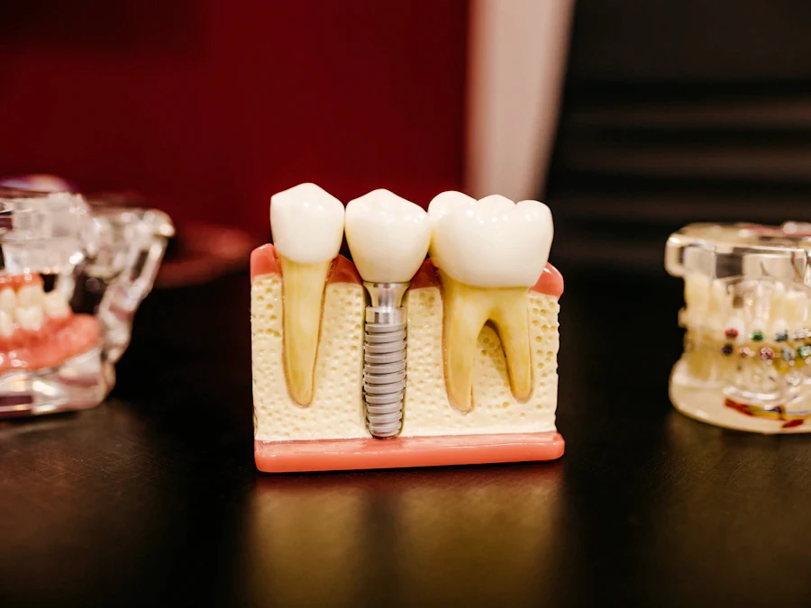 Dentist reviewing an implant scan