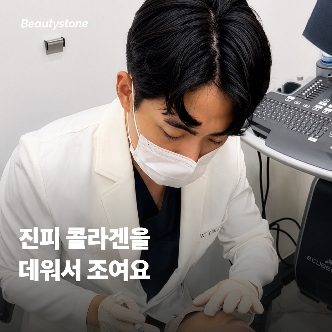올리지오 엑스 RF가 중안면 탄력을 잡아주는 원리