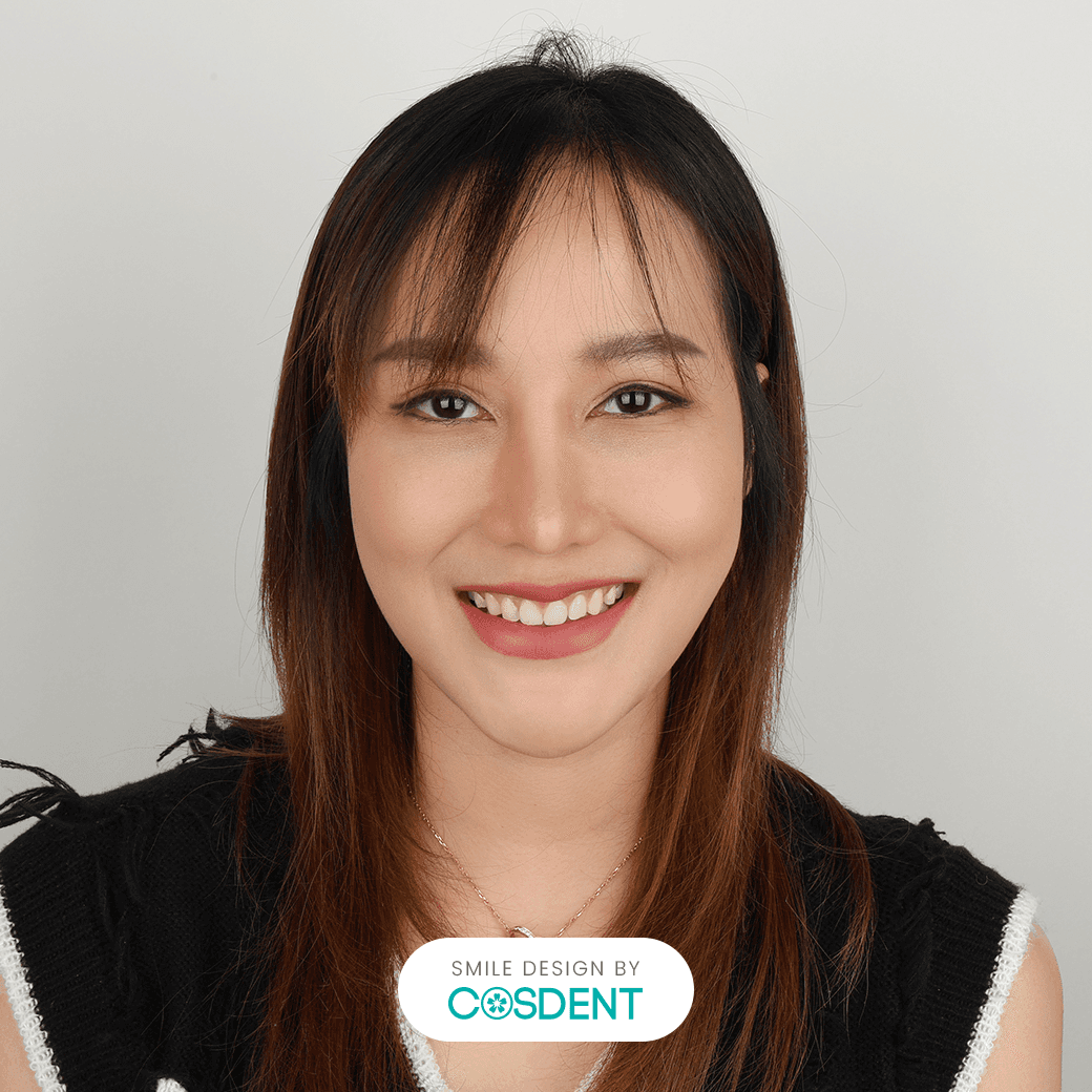 หน้ายาว ยิ้มกว้าง 16 ซี่