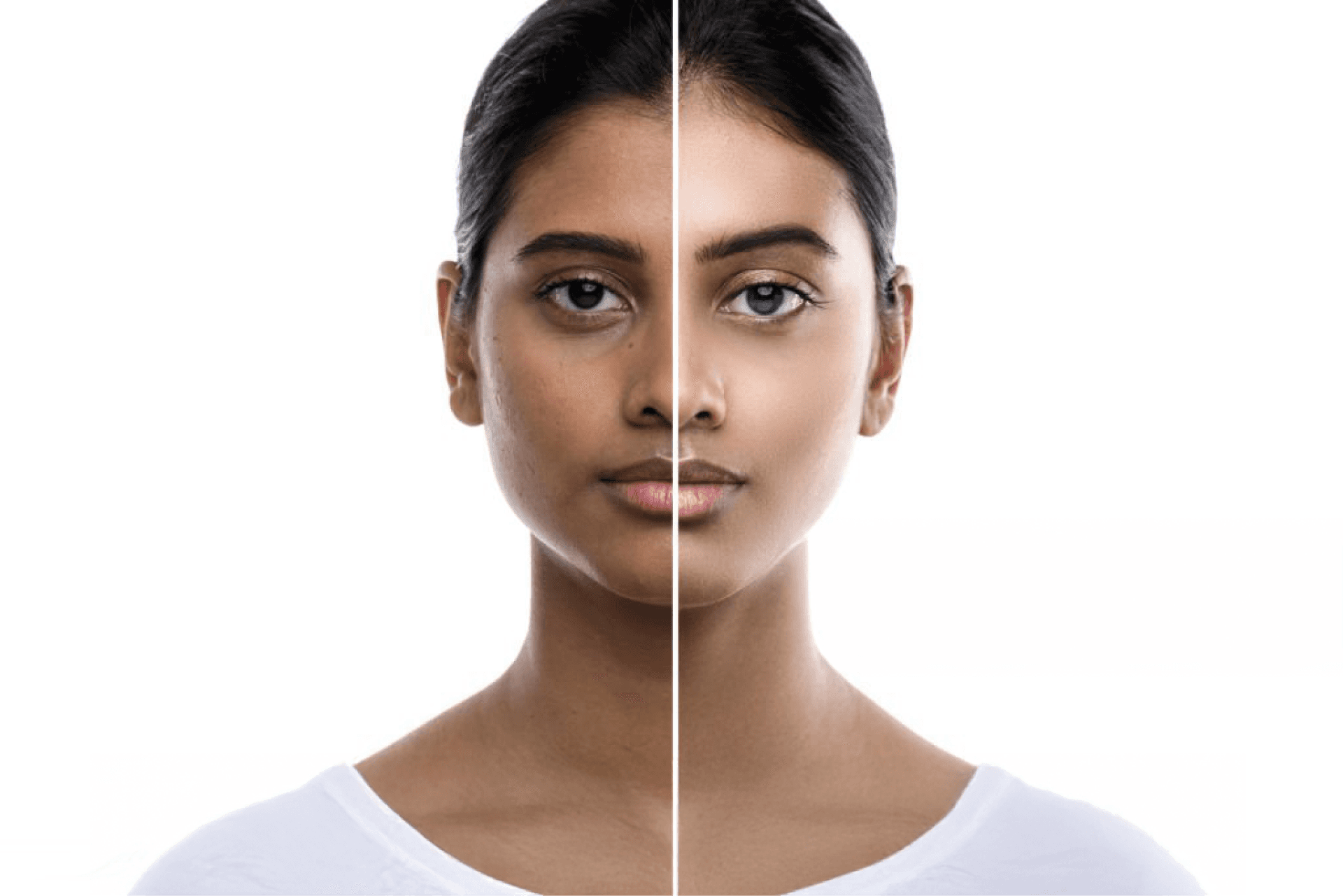 A woman with before and after comparison of her skin tone