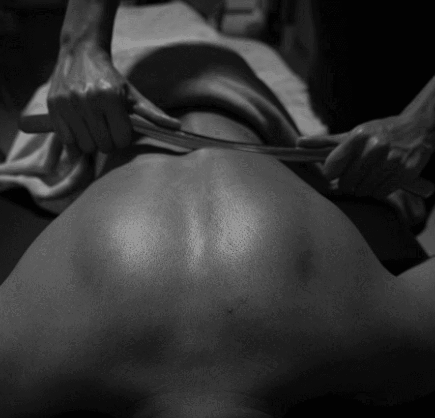 iastm on back (instrument assisted soft tissue mobilization)