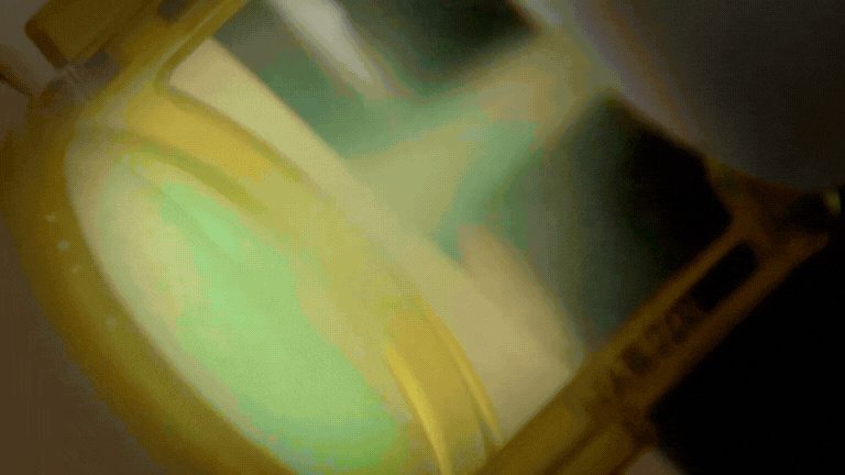 제모 통증과 화상 걱정? 젠틀맥스 DCD 냉각 시스템이 해결해 드립니다