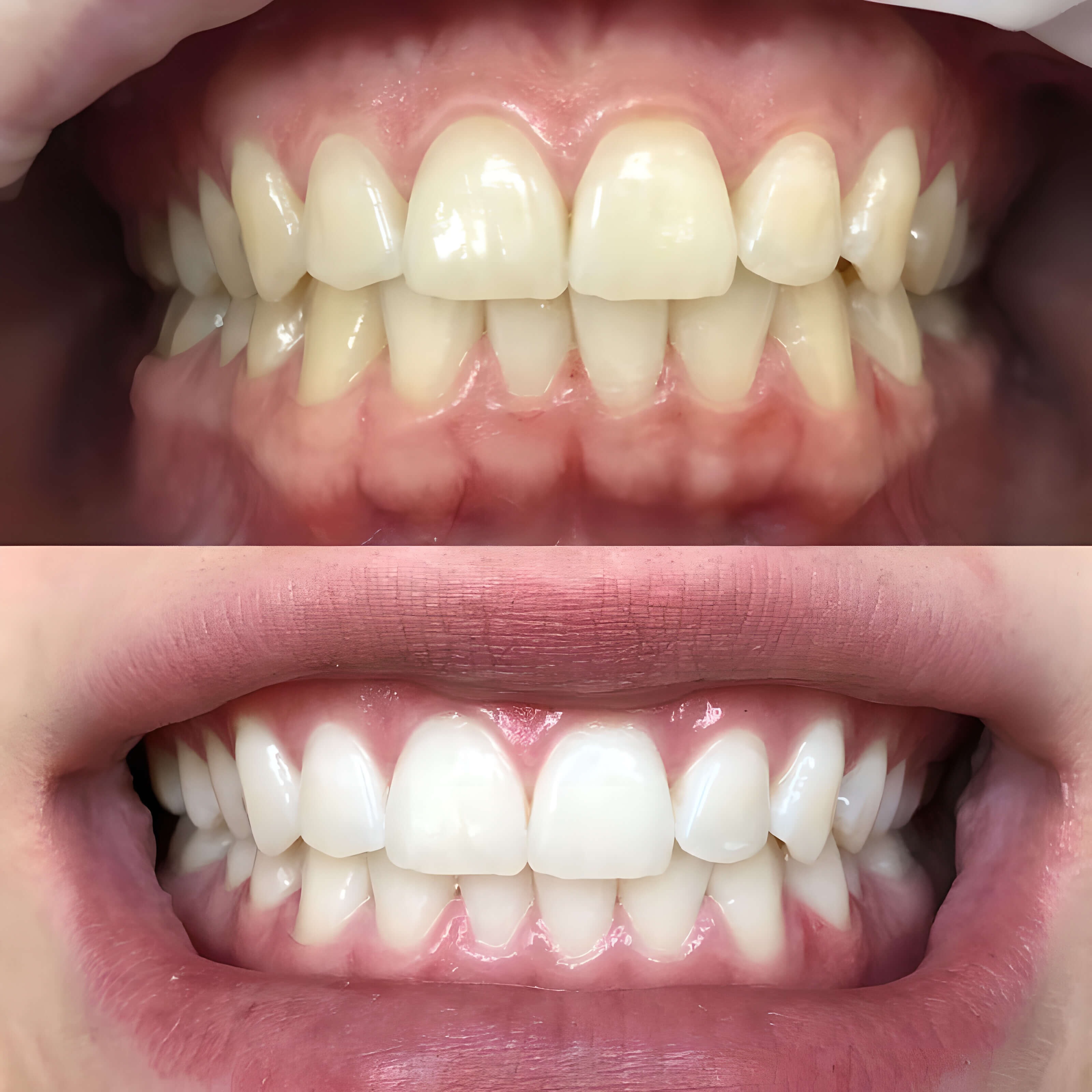 Minimal beige canvas tote bag with sturdy handles and a small leather tag on a light gray studio background.
