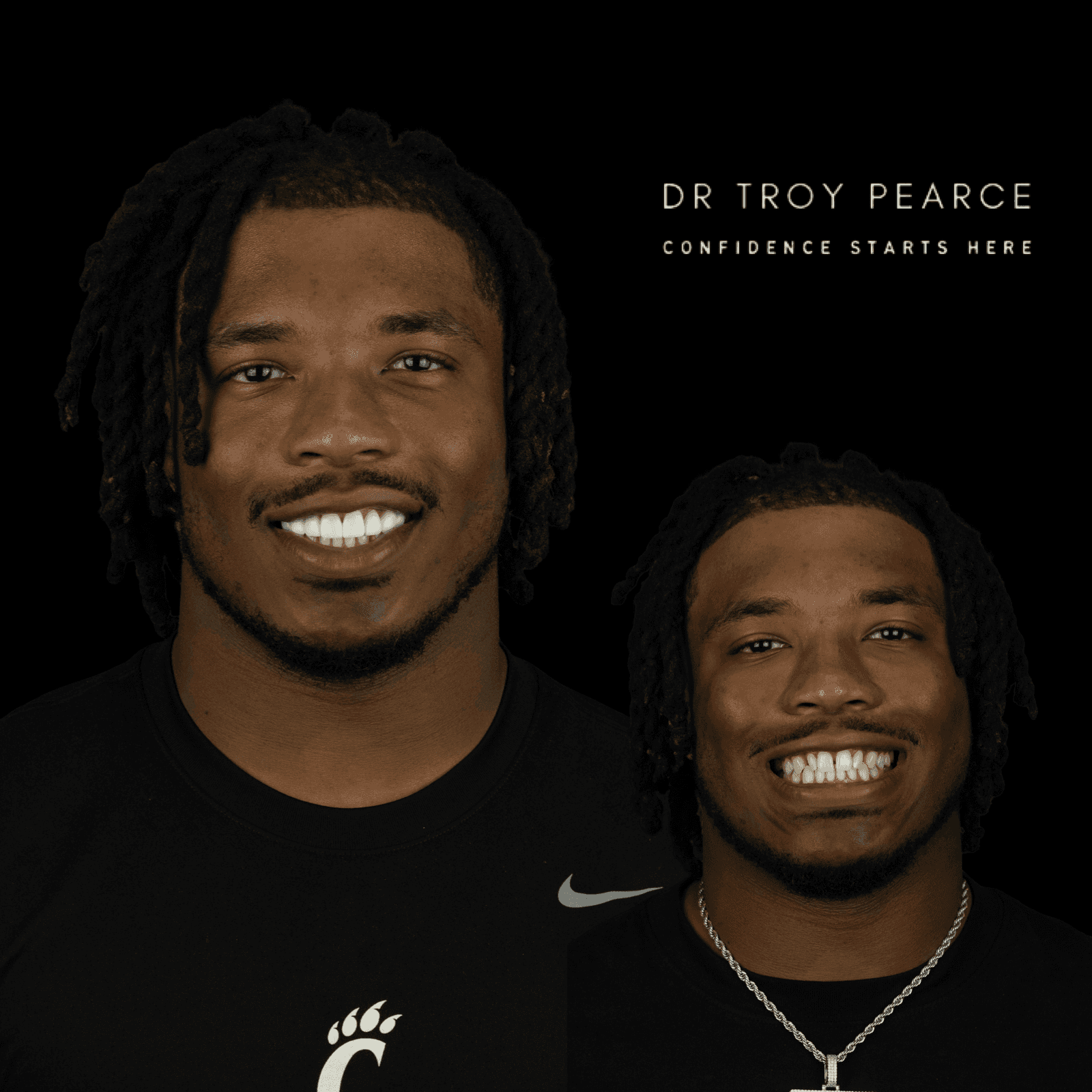 dental bonding candidate