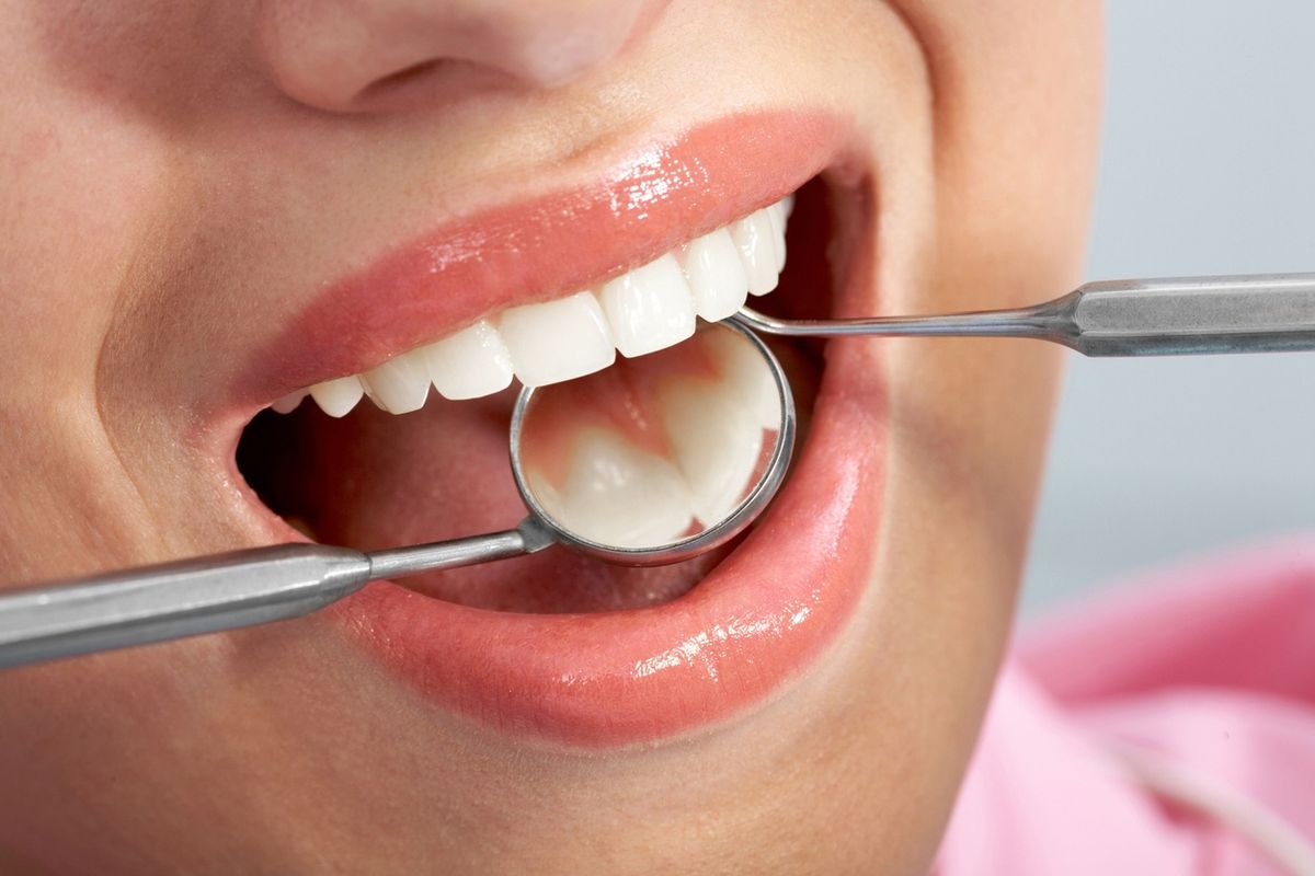 Teeth Checkup