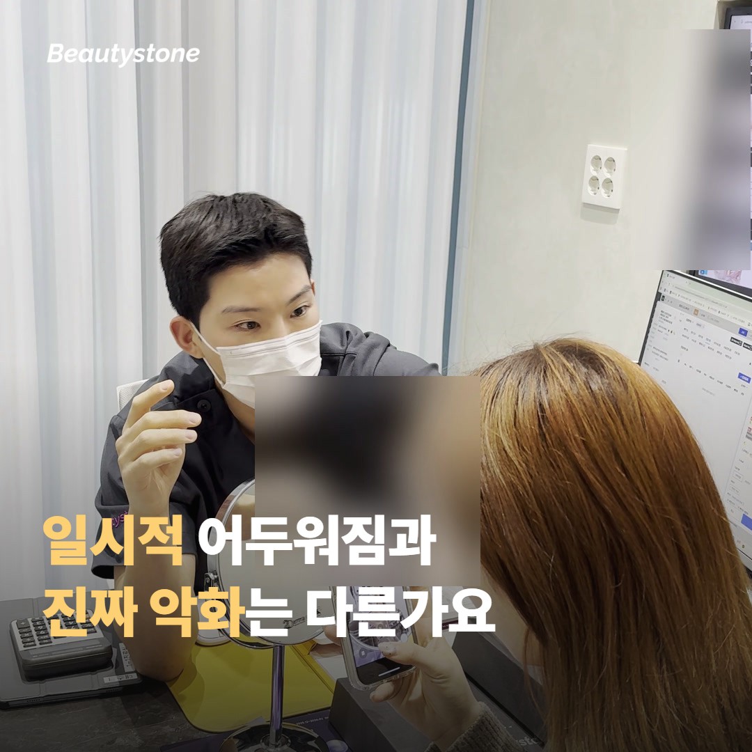일시적 어두워짐과 진짜 악화는 어떻게 다른가요