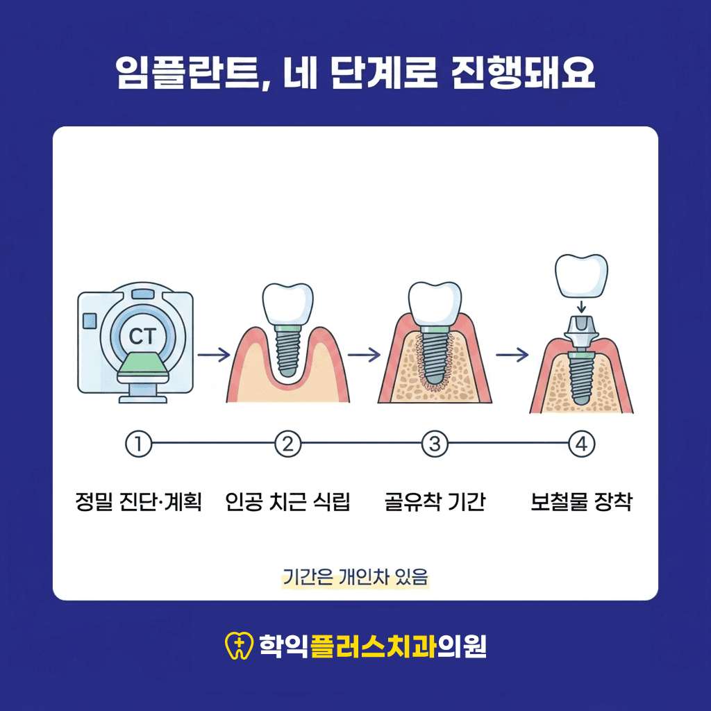 임플란트 진행 4단계 — 정밀 진단·식립·골유착·보철 장착