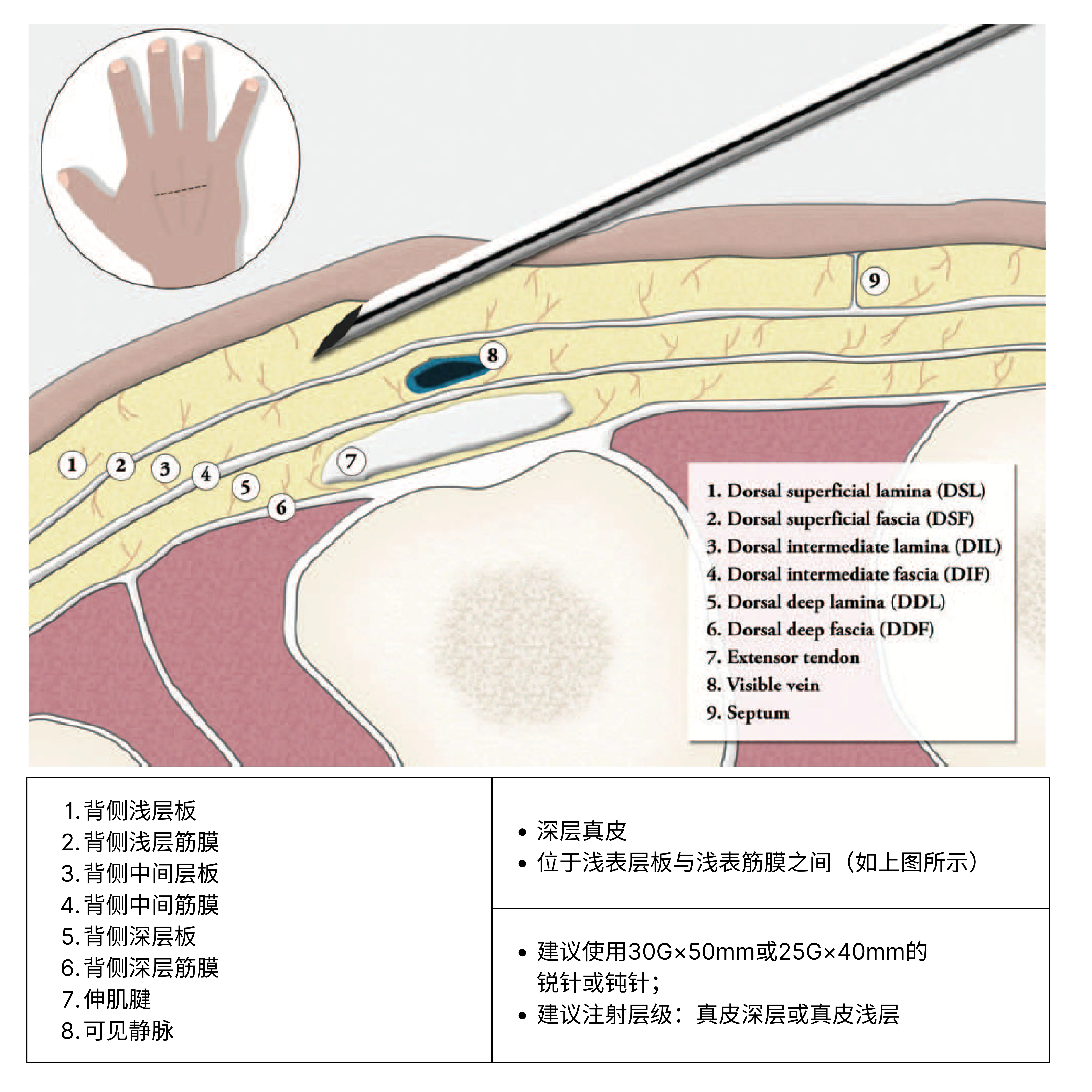 交联透明质酸钠凝胶制造商